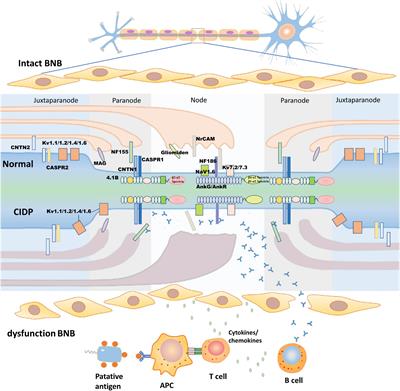 Impact of Neurofascin on Chronic Inflammatory Demyelinating Polyneuropathy via Changing the Node of Ranvier Function: A Review